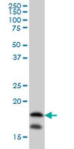 NME2 Antibody in Western Blot (WB)