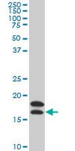 NME2 Antibody in Western Blot (WB)