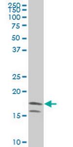 NME2 Antibody in Western Blot (WB)
