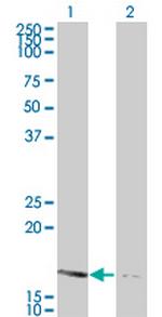 NME2 Antibody in Western Blot (WB)