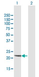 NQO2 Antibody in Western Blot (WB)