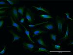 NQO2 Polyclonal Antibody, MaxPab™