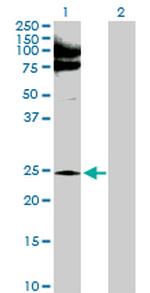 NQO2 Antibody in Western Blot (WB)