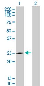 NQO2 Monoclonal Antibody (3E8-G2)