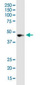 NODAL Monoclonal Antibody (5C3)