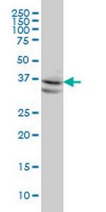 NODAL Monoclonal Antibody (5H3)
