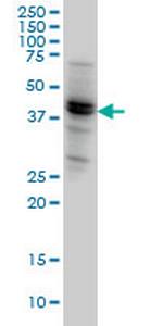 NODAL Monoclonal Antibody (5A3)