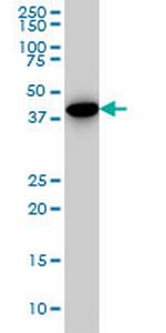 CNOT2 Monoclonal Antibody (3F1)