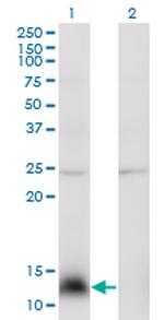 NPY Monoclonal Antibody (3B5)