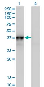 NOV Monoclonal Antibody (3C2)
