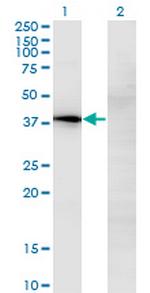 NOV Monoclonal Antibody (2G8)