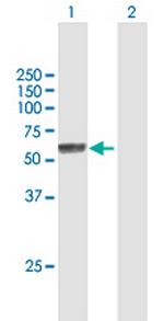 NOVA1 Antibody in Western Blot (WB)