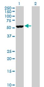 NOVA1 Antibody in Western Blot (WB)