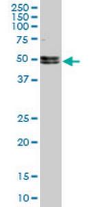 NOVA1 Antibody in Western Blot (WB)