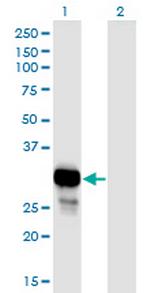 NP Monoclonal Antibody (6E5)