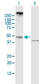 NPY5R Polyclonal Antibody, MaxPab™