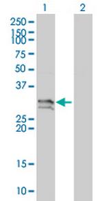 NT5E Monoclonal Antibody (4C4-2B5)