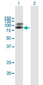 NTRK2 Antibody in Western Blot (WB)