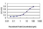 NTRK2 Antibody in ELISA (ELISA)