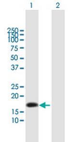 NTS Antibody in Western Blot (WB)