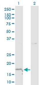 NTS Antibody in Western Blot (WB)
