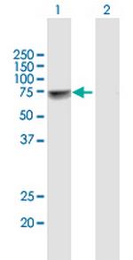 NUP98 Polyclonal Antibody, MaxPab™