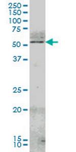 NR4A2 Monoclonal Antibody (1G6)