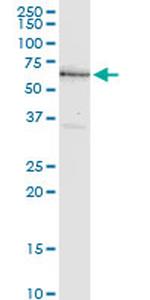 NR4A2 Antibody in Western Blot (WB)