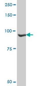 NVL Antibody in Western Blot (WB)
