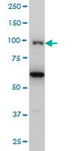 OCRL Monoclonal Antibody (4A6)