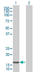 OMP Polyclonal Antibody, MaxPab™