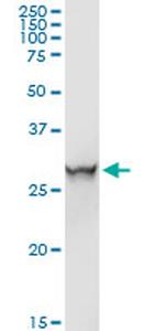 ORM1 Antibody in Western Blot (WB)