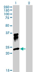 ORM1 Antibody in Western Blot (WB)
