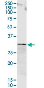ORM1 Antibody in Western Blot (WB)