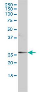 ORM1 Monoclonal Antibody (2F9-1F10)