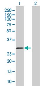 OSM Polyclonal Antibody, MaxPab™