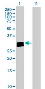 OSM Polyclonal Antibody, MaxPab™