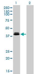 OTX1 Monoclonal Antibody (1F2)