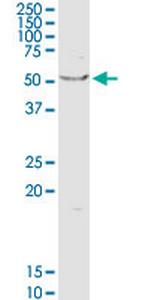 OXCT1 Polyclonal Antibody, MaxPab™