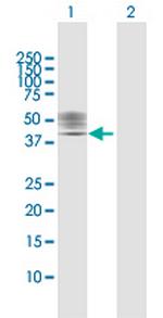 P2RX1 Polyclonal Antibody, MaxPab™