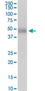 P2RX5 Antibody in Western Blot (WB)