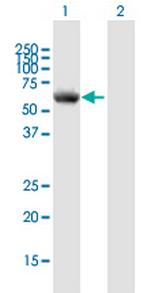 P4HA1 Polyclonal Antibody, MaxPab™