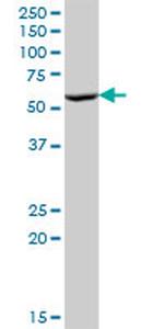 P4HB Antibody in Western Blot (WB)
