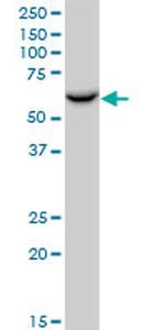 P4HB Antibody in Western Blot (WB)