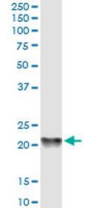 PBP Monoclonal Antibody (2G2-1F1)
