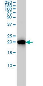 PBP Monoclonal Antibody (1D3-1B6)