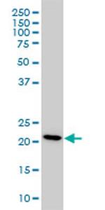 PBP Monoclonal Antibody (M2)