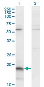 PAEP Monoclonal Antibody (6G2)