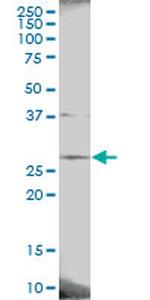 PAFAH1B3 Antibody in Western Blot (WB)