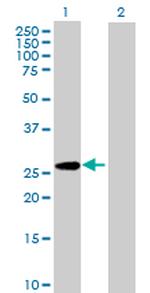PAFAH1B3 Antibody in Western Blot (WB)